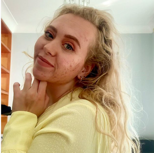 Normalize seeing real skin